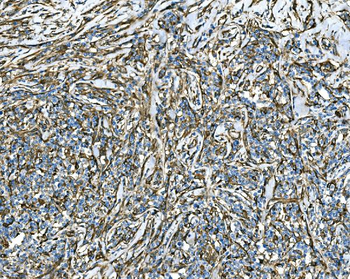 Anti-RAB13 Antibody