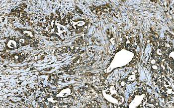 Anti-RAB13 Antibody