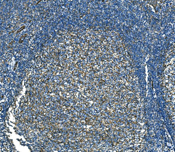 Anti-RAB13 Antibody