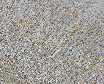 Anti-RAB13 Antibody