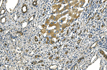 Anti-NLRP7 Antibody