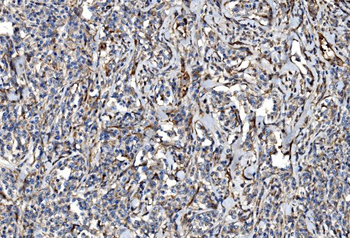 Anti-NLRP7 Antibody