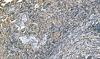 Anti-NEDD4 Antibody
