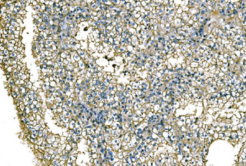 Anti-NEDD4 Antibody