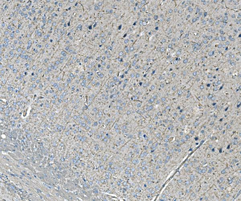 Anti-NEDD4 Antibody