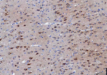 Anti-LNPEP Antibody