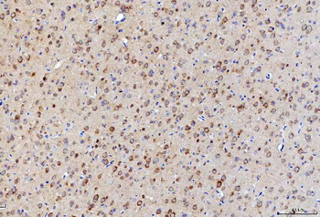 Anti-LNPEP Antibody