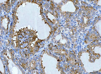 Anti-KRT7 Antibody