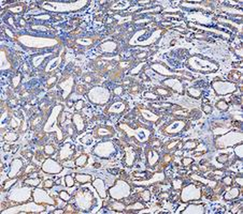Anti-KRT7 Antibody