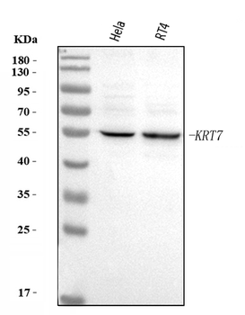 Anti-KRT7 Antibody