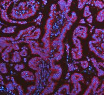 Anti-KRT7 Antibody