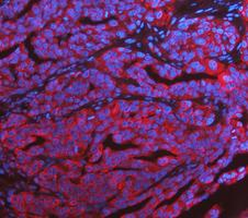 Anti-KRT7 Antibody