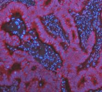 Anti-KRT7 Antibody
