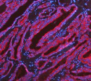Anti-KRT7 Antibody