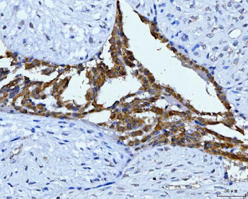 Anti-KRT7 Antibody