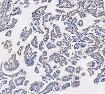Anti-KRT7 Antibody