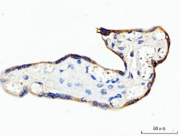 Anti-KRT7 Antibody