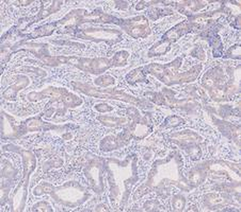 Anti-KRT7 Antibody
