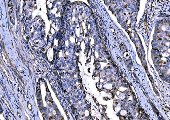 Anti-KPNA2 Antibody
