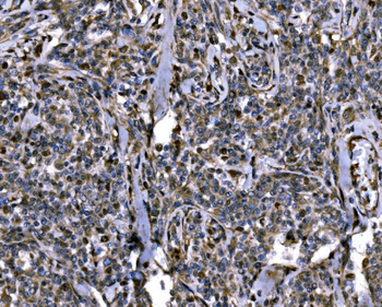 Anti-KPNA2 Antibody