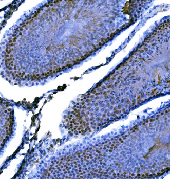 Anti-KPNA2 Antibody