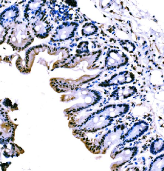 Anti-KLF4 Antibody