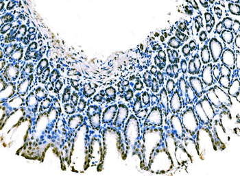 Anti-KLF4 Antibody