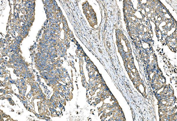 Anti-IMPDH1 Antibody