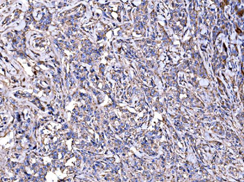 Anti-IMPDH1 Antibody