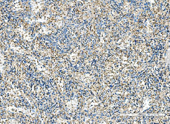 Anti-IMPDH1 Antibody