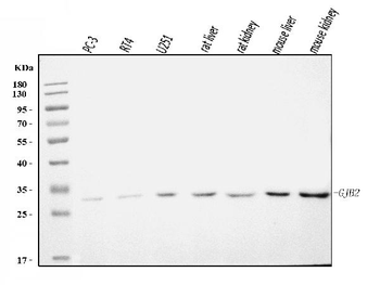 Anti-GJB2 Antibody