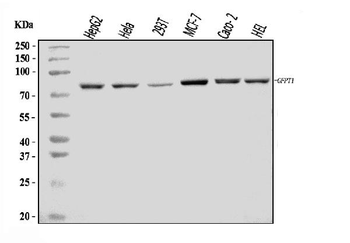 Anti-GFPT1 Antibody