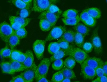 Anti-GFPT1 Antibody