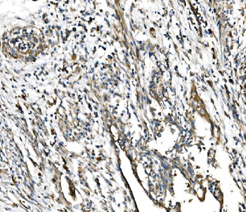 Anti-GFPT1 Antibody
