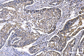 Anti-GFPT1 Antibody