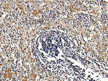 Anti-GFPT1 Antibody