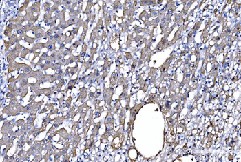 Anti-GFPT1 Antibody