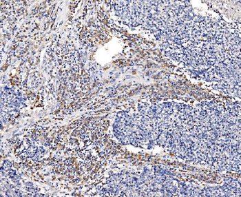 Anti-GFPT1 Antibody