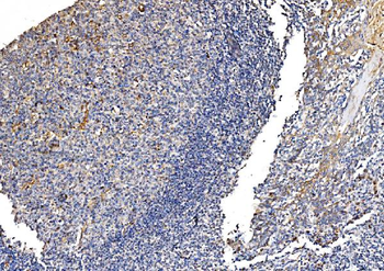 Anti-GFPT1 Antibody