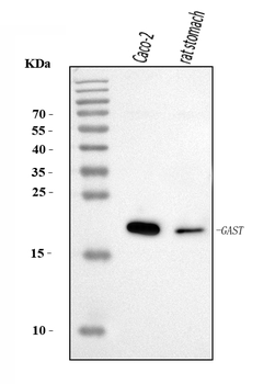 Anti-Gastrin/GAST Antibody
