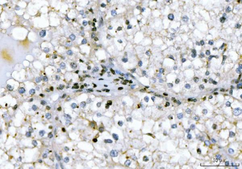 Anti-GADD45B Antibody