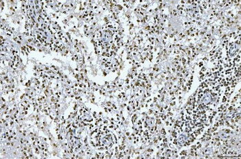Anti-GADD45B Antibody