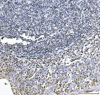 Anti-GADD45B Antibody