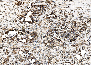 Anti-G3BP/G3BP1 Antibody