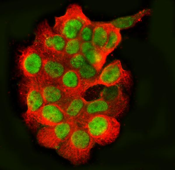 Anti-TLS/FUS Antibody