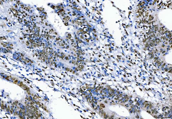 Anti-TLS/FUS Antibody