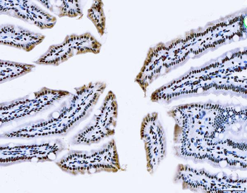 Anti-TLS/FUS Antibody