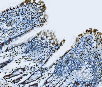 Anti-TLS/FUS Antibody