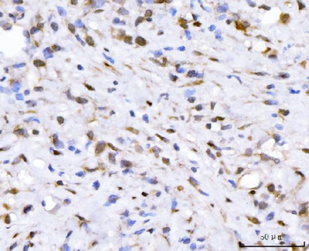 Anti-FGF2 Antibody