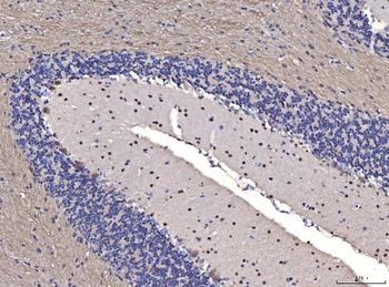 Anti-FGF2 Antibody